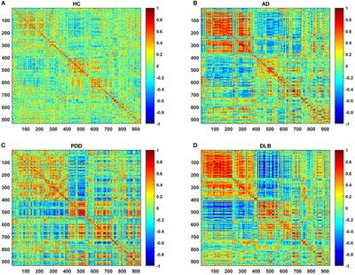 Brain Network and Abnormal Hemispheric Asymmetry Analyses to Explore the Marginal Differences in Glucose Metabolic Distributions Among Alzheimer's Disease, Parkinson's Disease Dementia, and Lewy Body Dementia